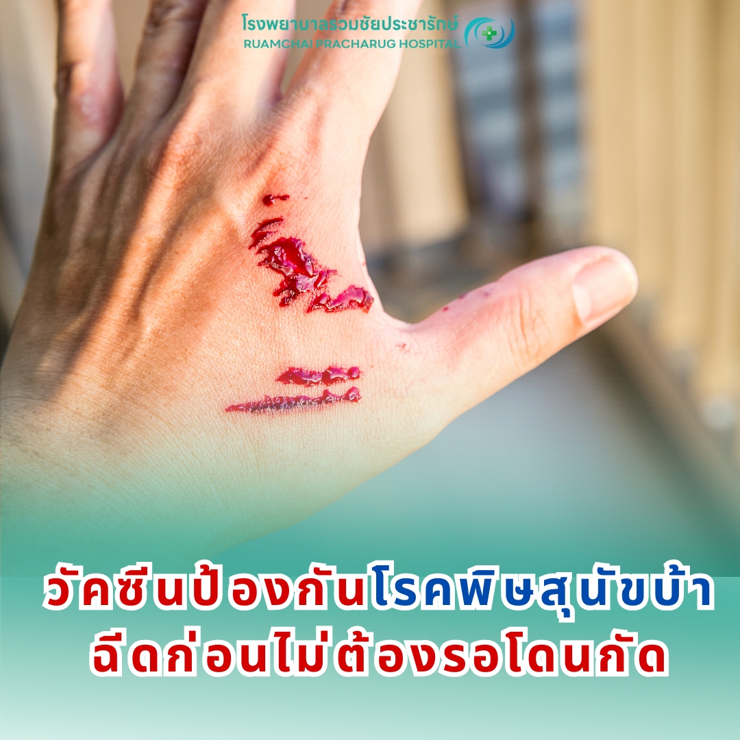 วัคซีนป้องกันพิษสุนัขบ้า